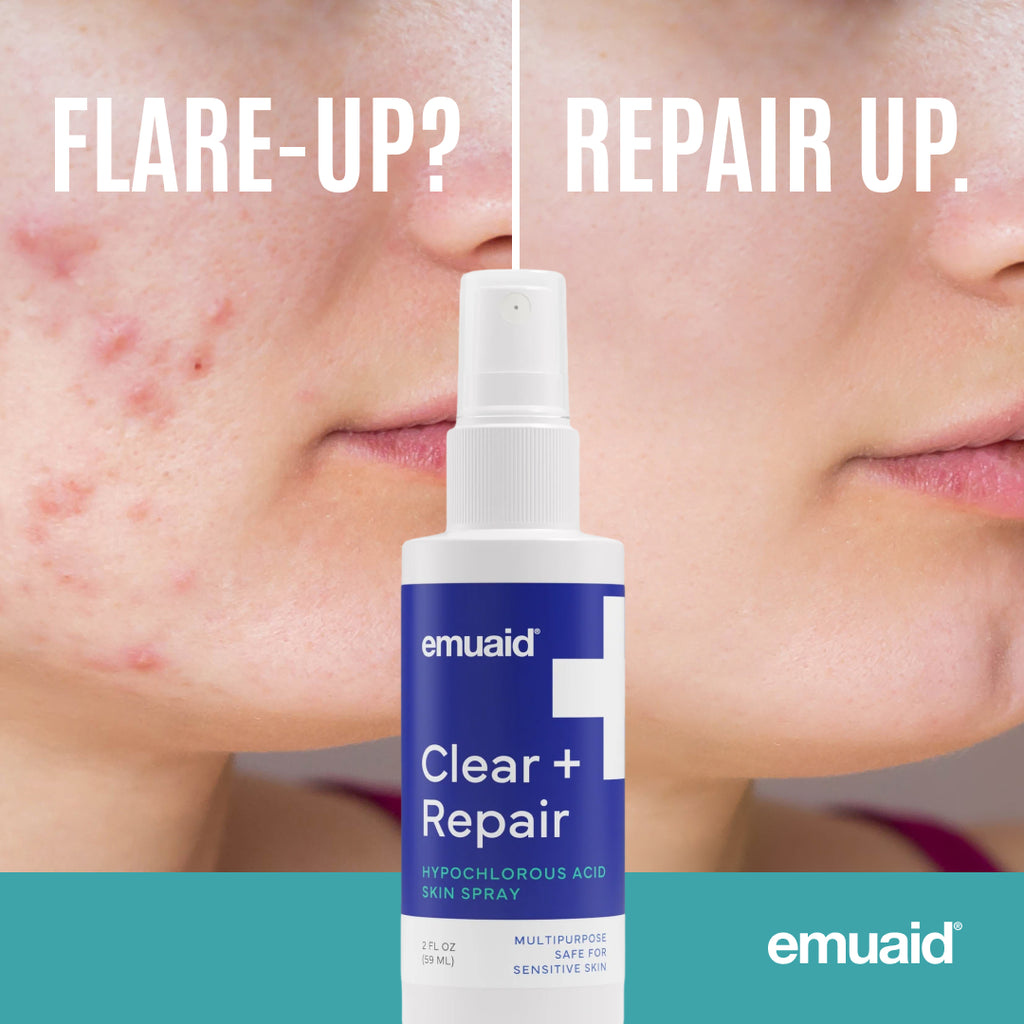 EMUAID Clear + Repair - Spray cutané à l'acide hypochloreux EMUAID Clear + Repair - Spray cutané à l'acide hypochloreux