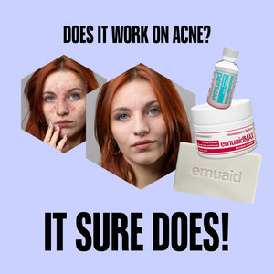 Trio d'effacement de l'acné EMUAID