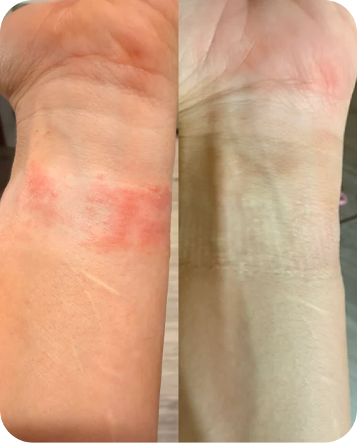 Résultats d'études cliniques