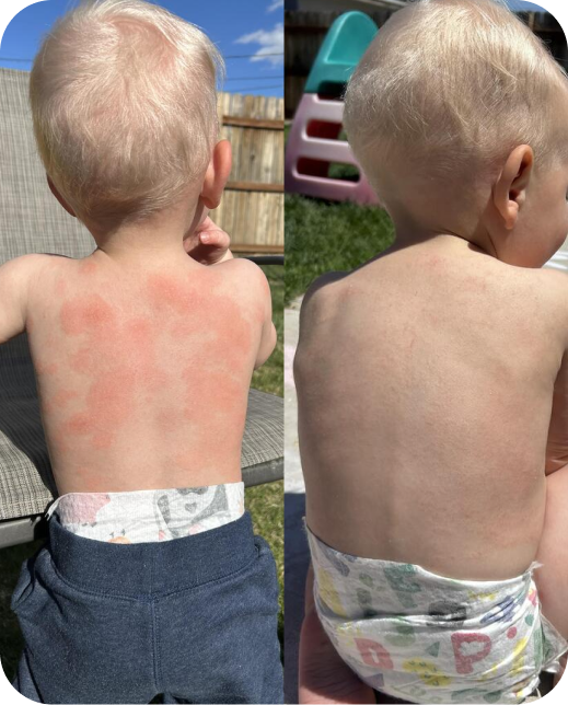 Résultats d'études cliniques