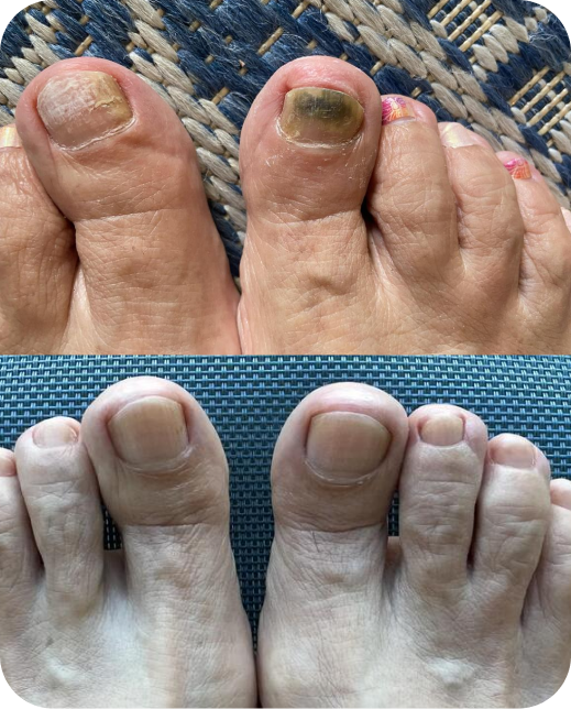 Résultats d'études cliniques