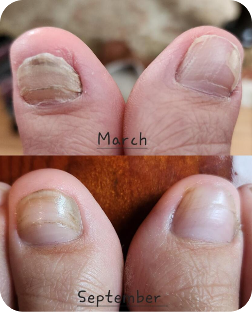 Résultats d'études cliniques