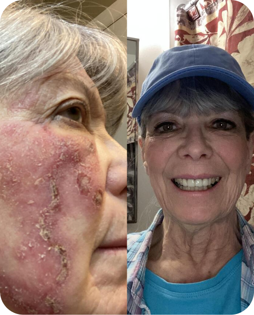 Résultats d'études cliniques