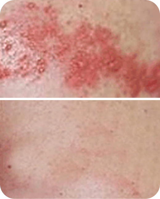 Résultats d'études cliniques