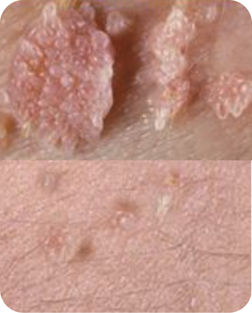 Résultats d'études cliniques