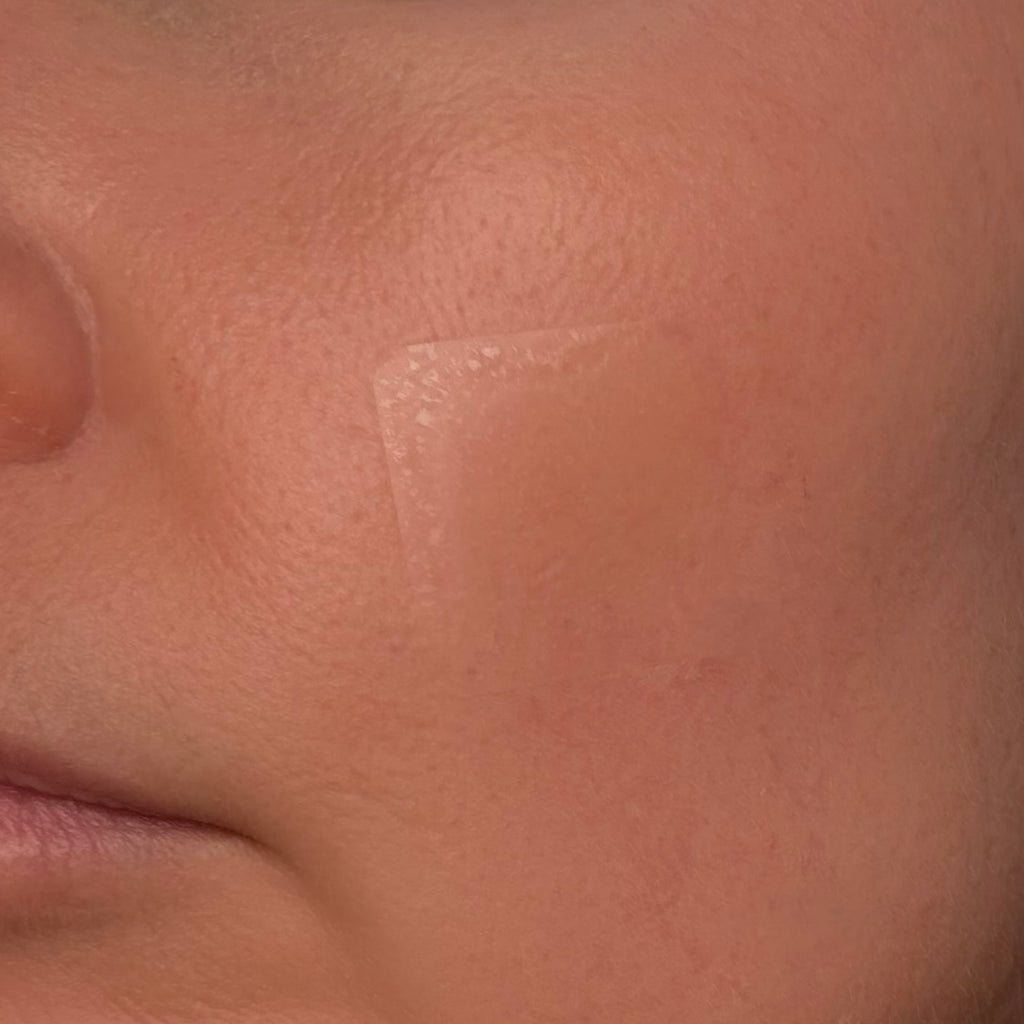 Patchs EMUAIDMAX Patchs EMUAIDMAX