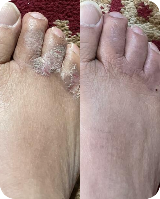 Résultats d'études cliniques