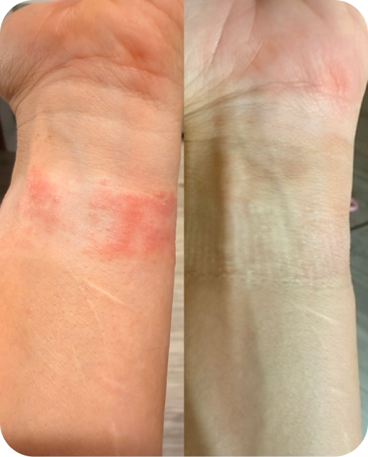 Résultats d'études cliniques