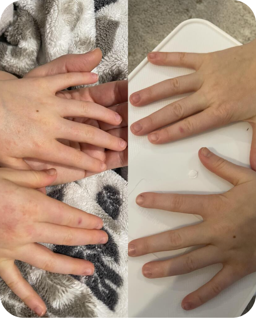 Résultats d'études cliniques