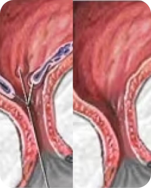 Résultats d'études cliniques