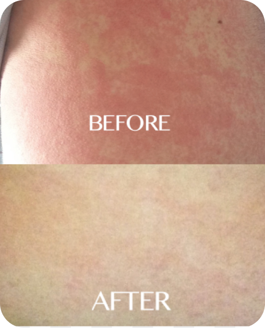 Résultats d'études cliniques